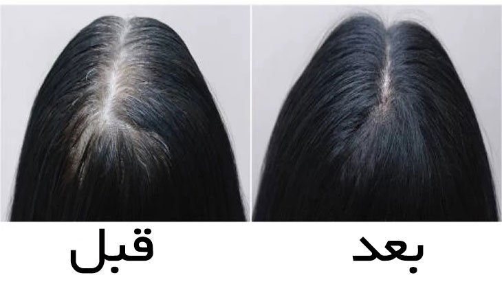 ترکیبات گیاهی معجزه گر، هم ضد ریزش مو و هم رنگ مو!